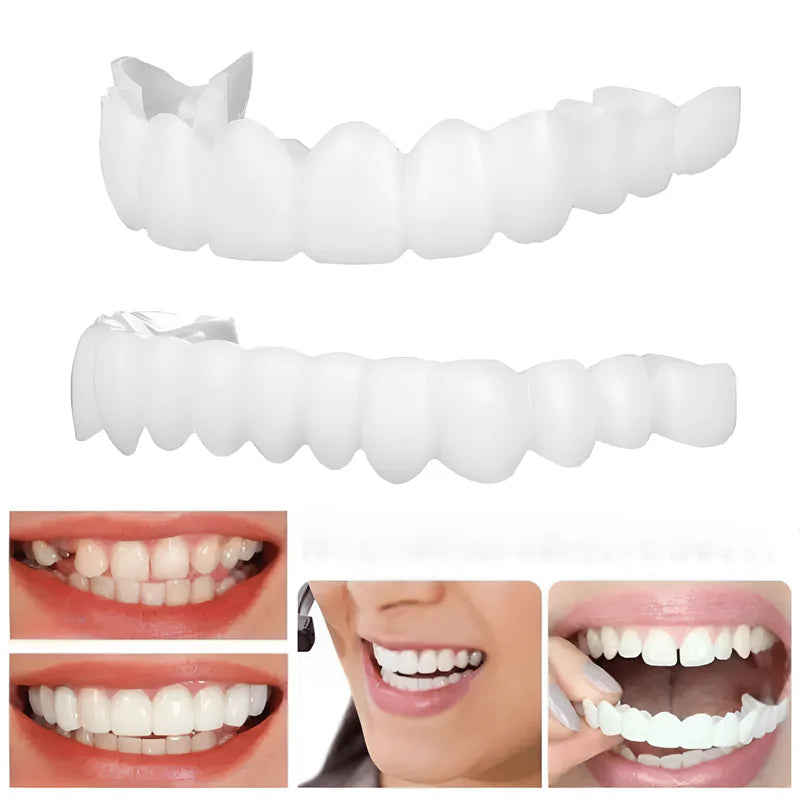 Facetas Dentárias | Nature Smilefix Pro® [COMPRE 1 LEVE 2]