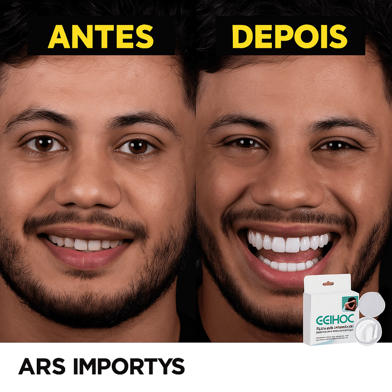 Facetas Dentárias Naturais Removíveis | SmileFix Pro [COMPRE 1 LEVE 2] - Ars importys