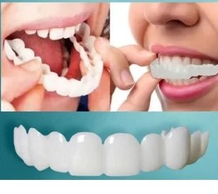 Facetas Dentárias Naturais Removíveis | SmileFix Pro [COMPRE 1 LEVE 2] - Ars importys