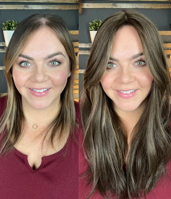Implante Capilar Natural para Mulheres Maduras | 100% Cabelo Humano — Falhas e Alopecia - Ars importys