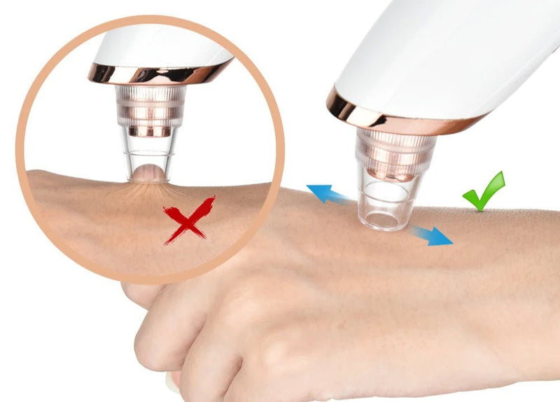 PureSkin – Removedor de Cravos com Sucção Profunda - Ars importys